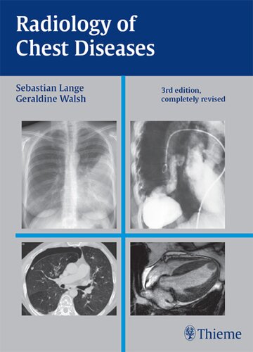 کتاب Radiology of Chest Diseases نسخه کامل